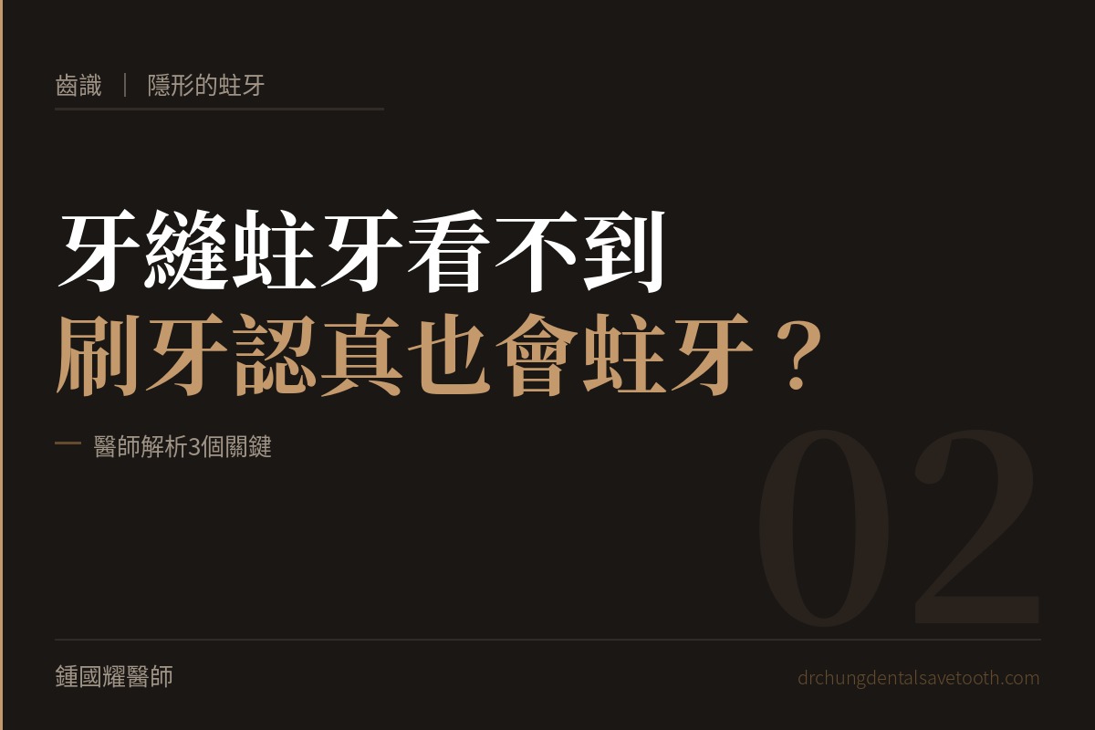 隱形的蛀牙 牙縫蛀牙看不到，刷牙認真也會蛀牙？醫師解析3個關鍵｜桃園鍾國耀醫師