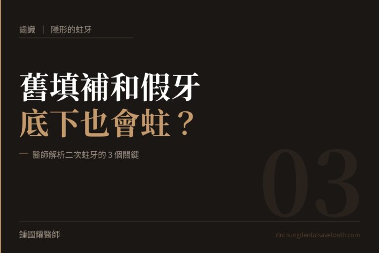 隱形的蛀牙 舊填補和假牙底下也會蛀？醫師解析二次蛀牙的3個關鍵｜桃園鍾國耀醫師